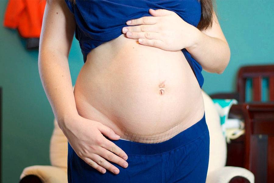 Беременность после кесарева сечения: ее основные особенности и возможные сложности