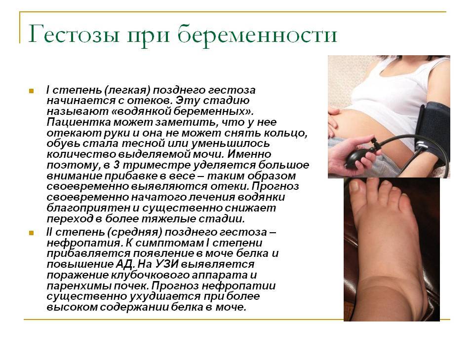 Токсикоз при беременности. дополнительный повод обратиться к врачу-гинекологу