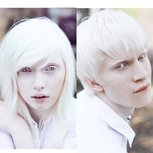 Люди альбиносы: особенность и возможные последствия