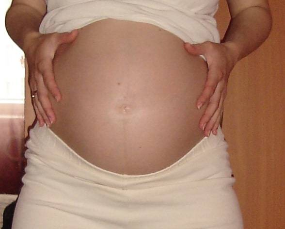 Ветрянка у беременных | педиатрия и неонатология