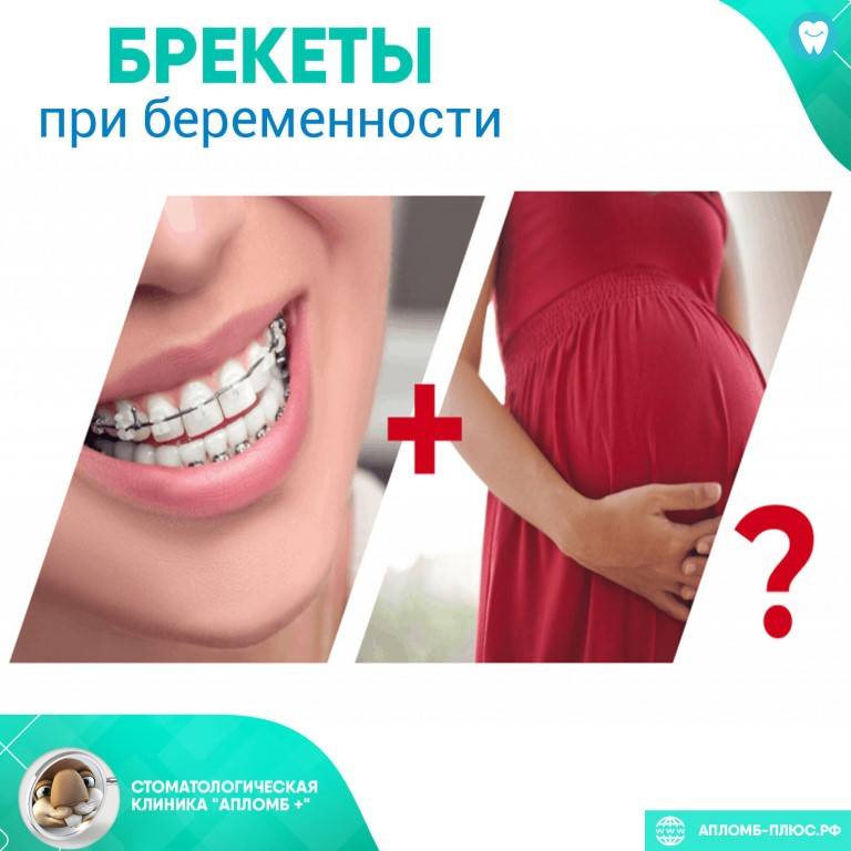 Удаление зуба во время беременности: можно или нельзя? что делать после удаления зуба?
