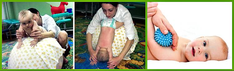 Гипотонус у младенцев | детский медицинский центр "чудодети"