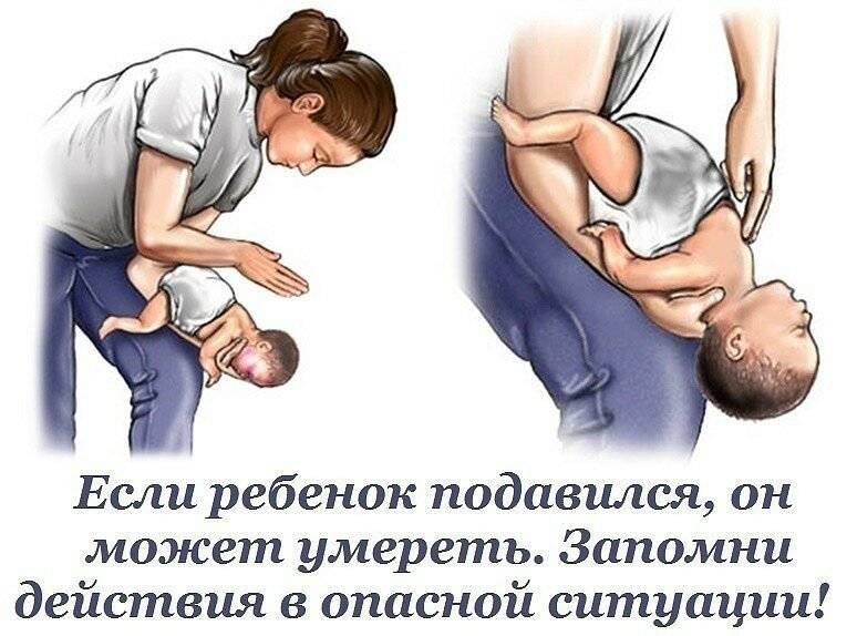 Ребенок подавился и задыхается: оказание первой помощи