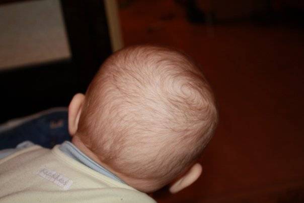 У грудничка выпадают волосы на голове: почему это бывает у новорожденных до года