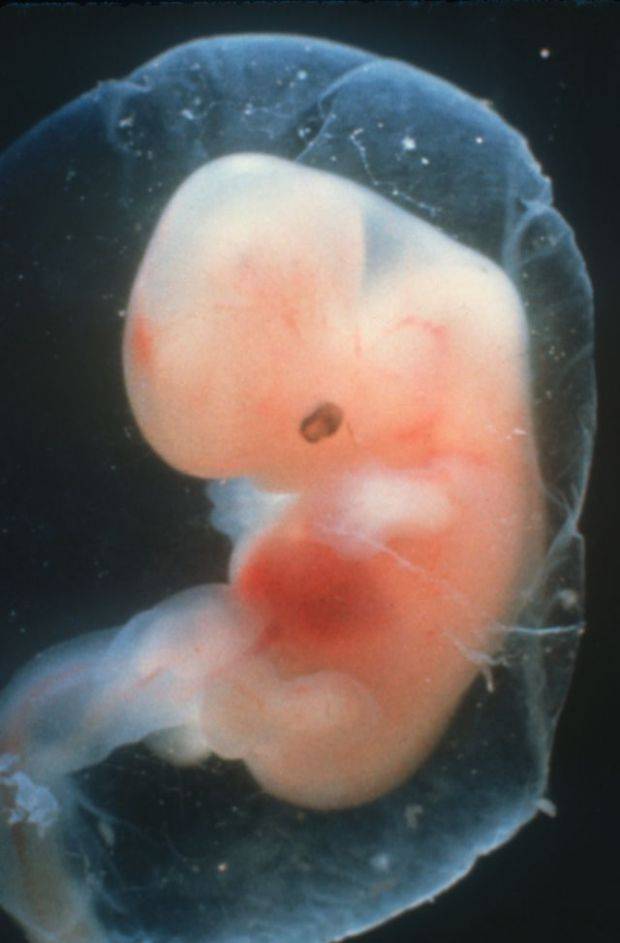 Как выглядит эмбрион на 5 неделе беременности фото