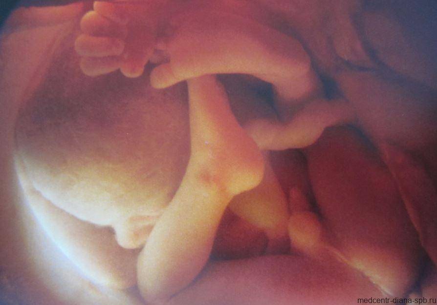 Фетометрия беременных — детальное узи мамы и малыша