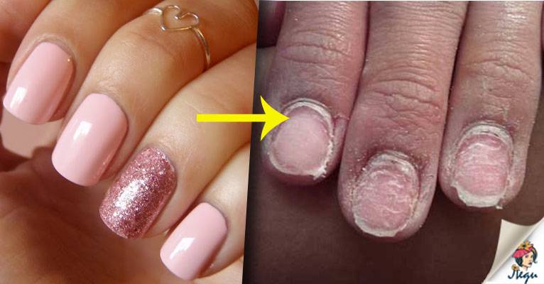 Можно ли беременным красить ногти гель-лаком и сушить их под лампой: особенности нанесения покрытия на ранних и поздних сроках