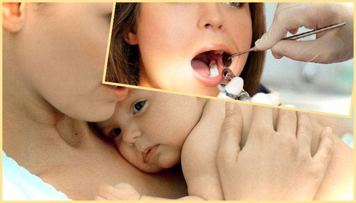 Лечение зубов при беременности и вскармливании в ярославле