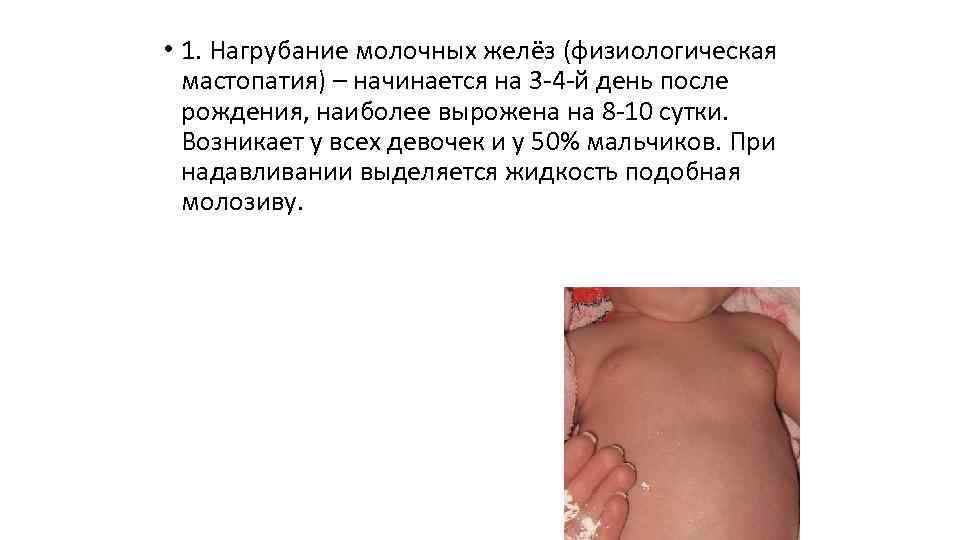 Причины нагрубания молочных желез у новорожденных детей