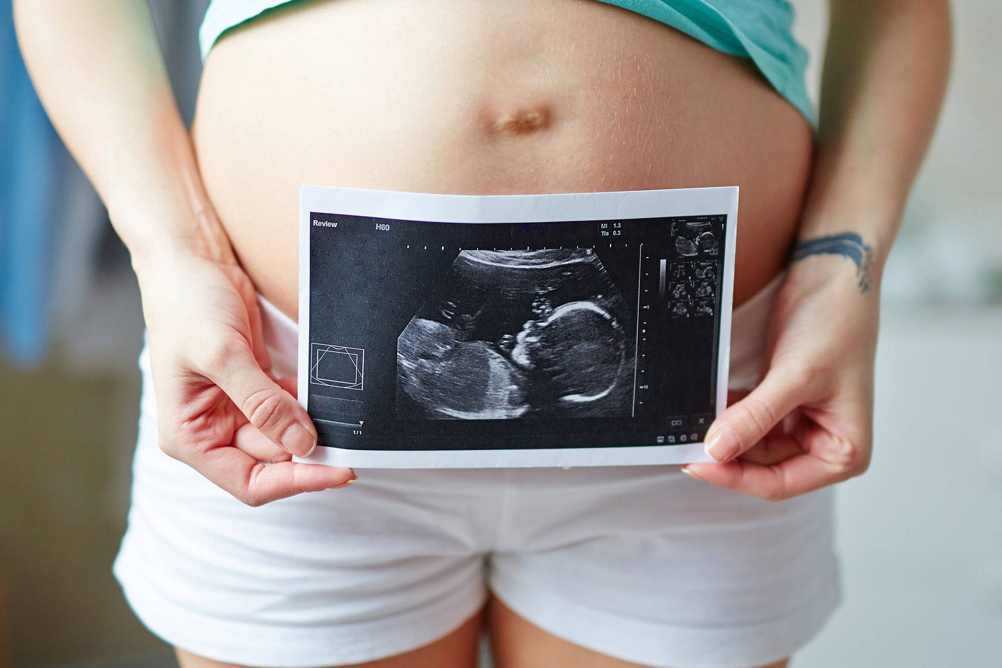 11 неделя беременности: что происходит, размер плода, фото узи, ощущения