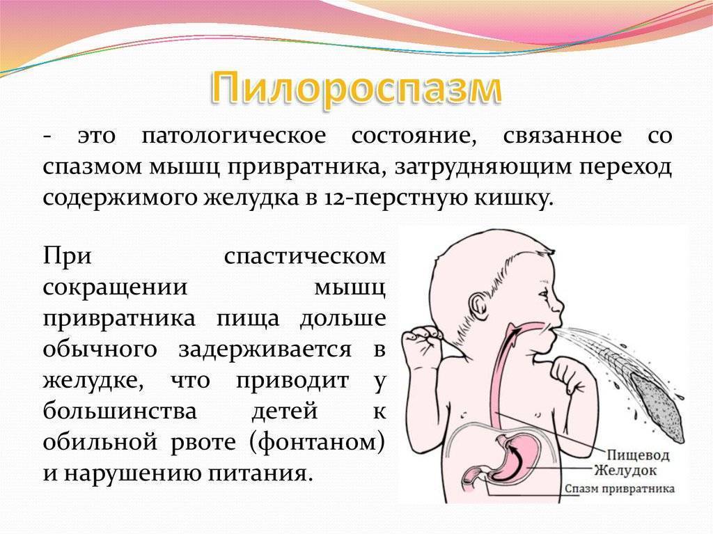 Синдром вертебральной артерии