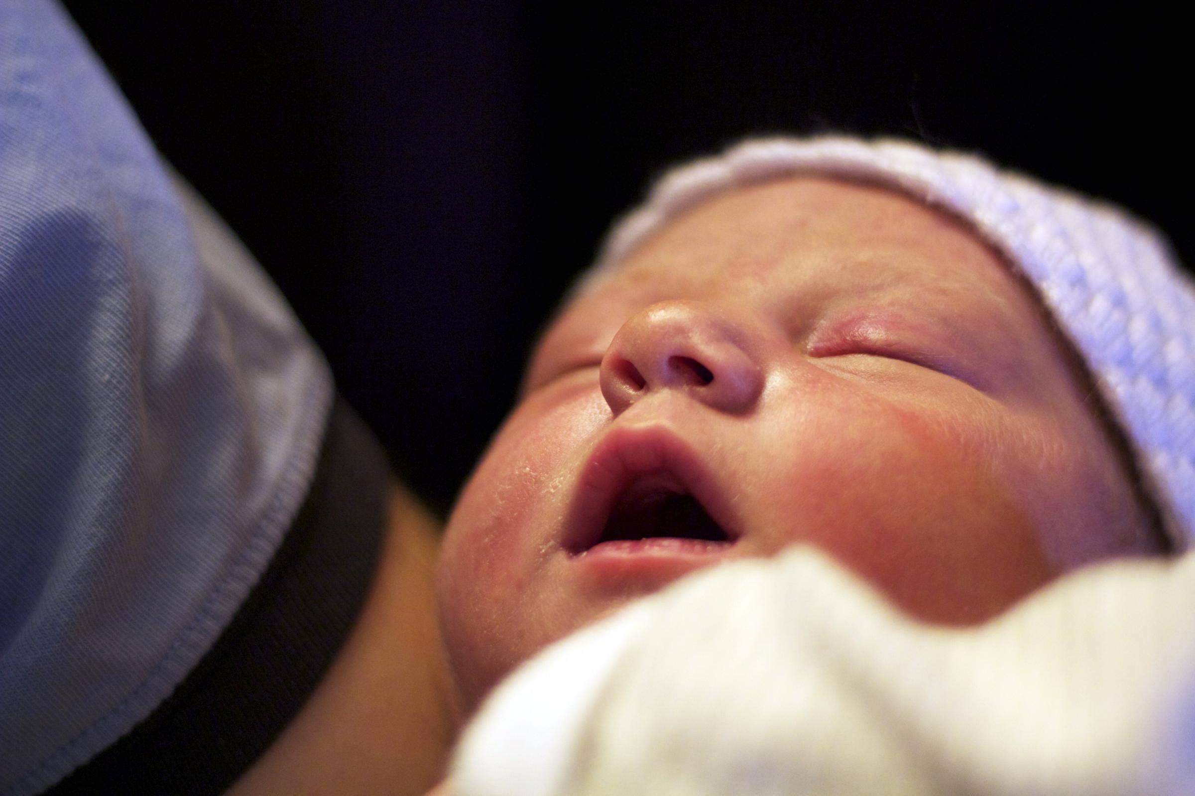Субэпендимальная киста (внутримозговая, церебральная) у новорожденного ребенка: лечение и последствия