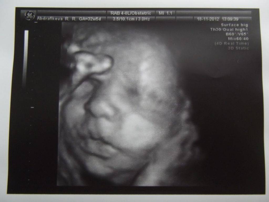 Как выглядят 26 недели беременности. 25 Недель беременности фото ребенка на УЗИ. Фото УЗИ 36 недель беременности. Снимки УЗИ В 36 недель беременности. Фото УЗИ на 35 недели беременности.