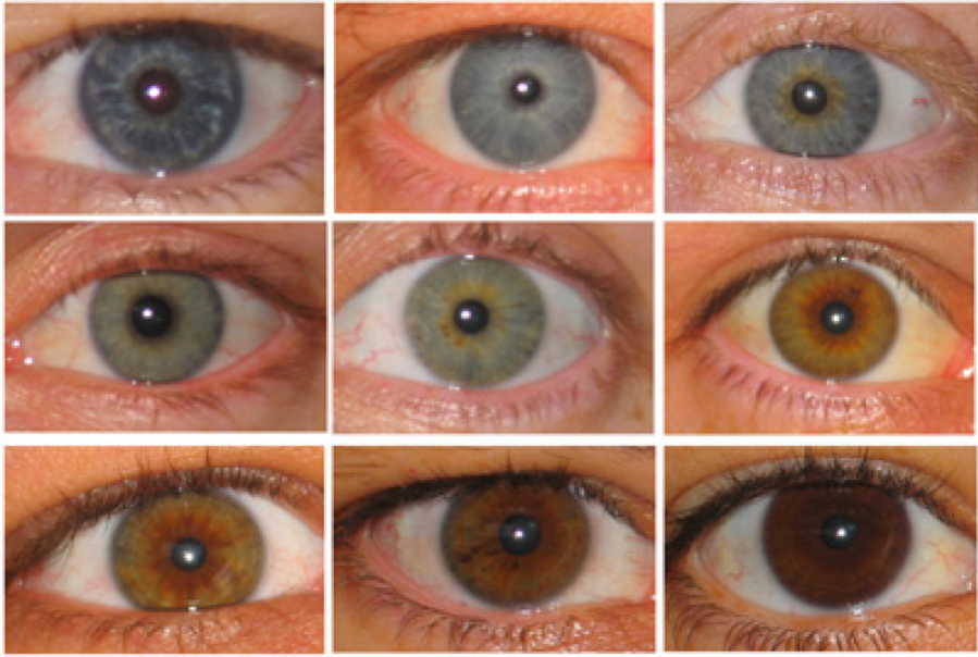 Серые белки глаз