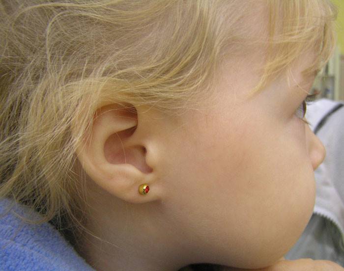 5 за и против прокалывания детских ушей: оптимальный возраст, время года и вид процедуры