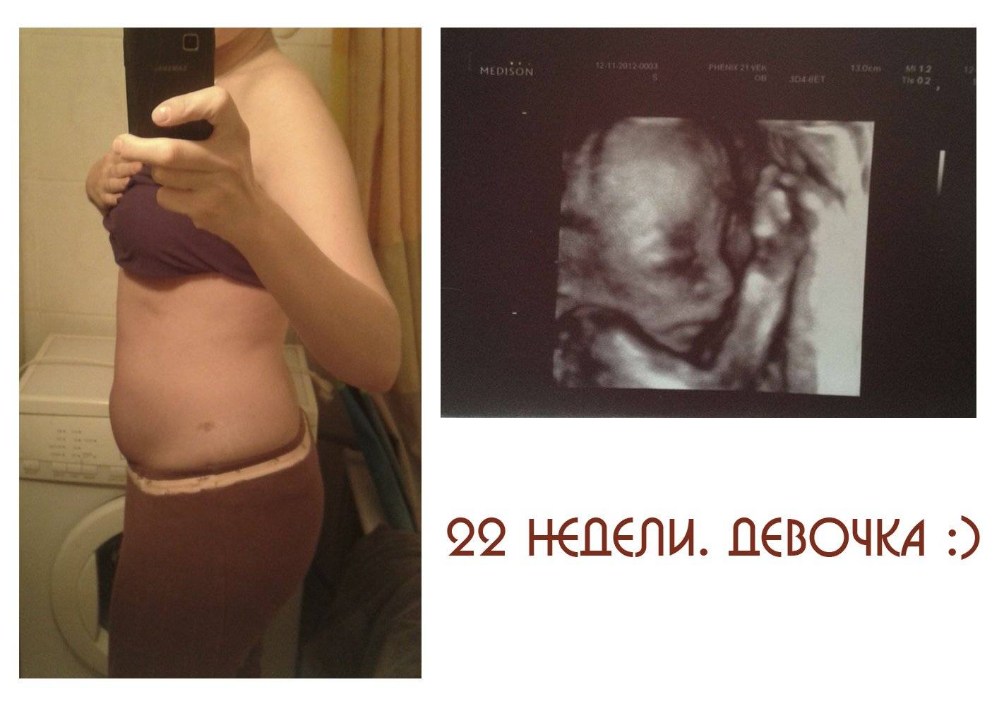Скрининг при беременности: все об узи беременных * клиника диана в санкт-петербурге