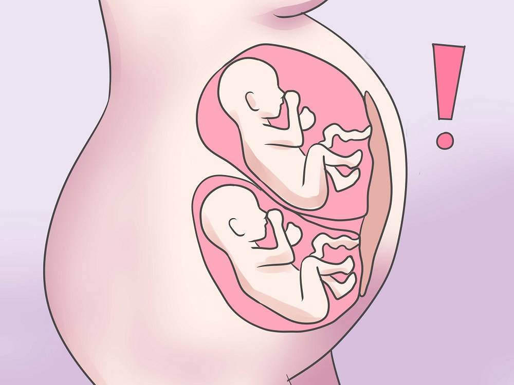 Признаки двойни на ранних сроках беременности, узи