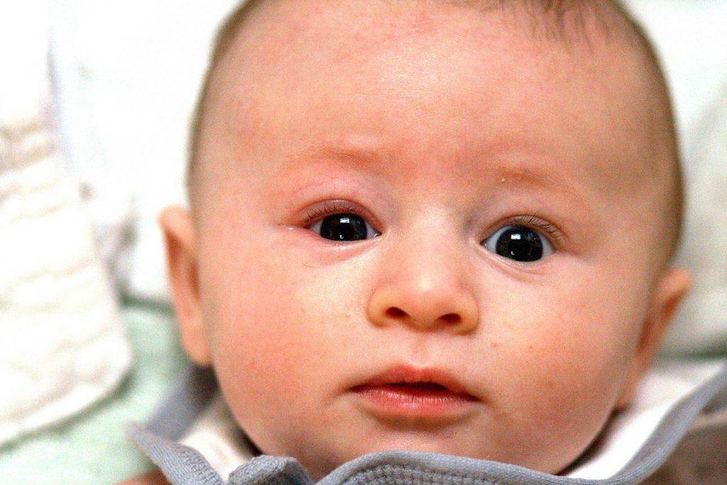 Причины закатывания глаз у детей и как с этим бороться?