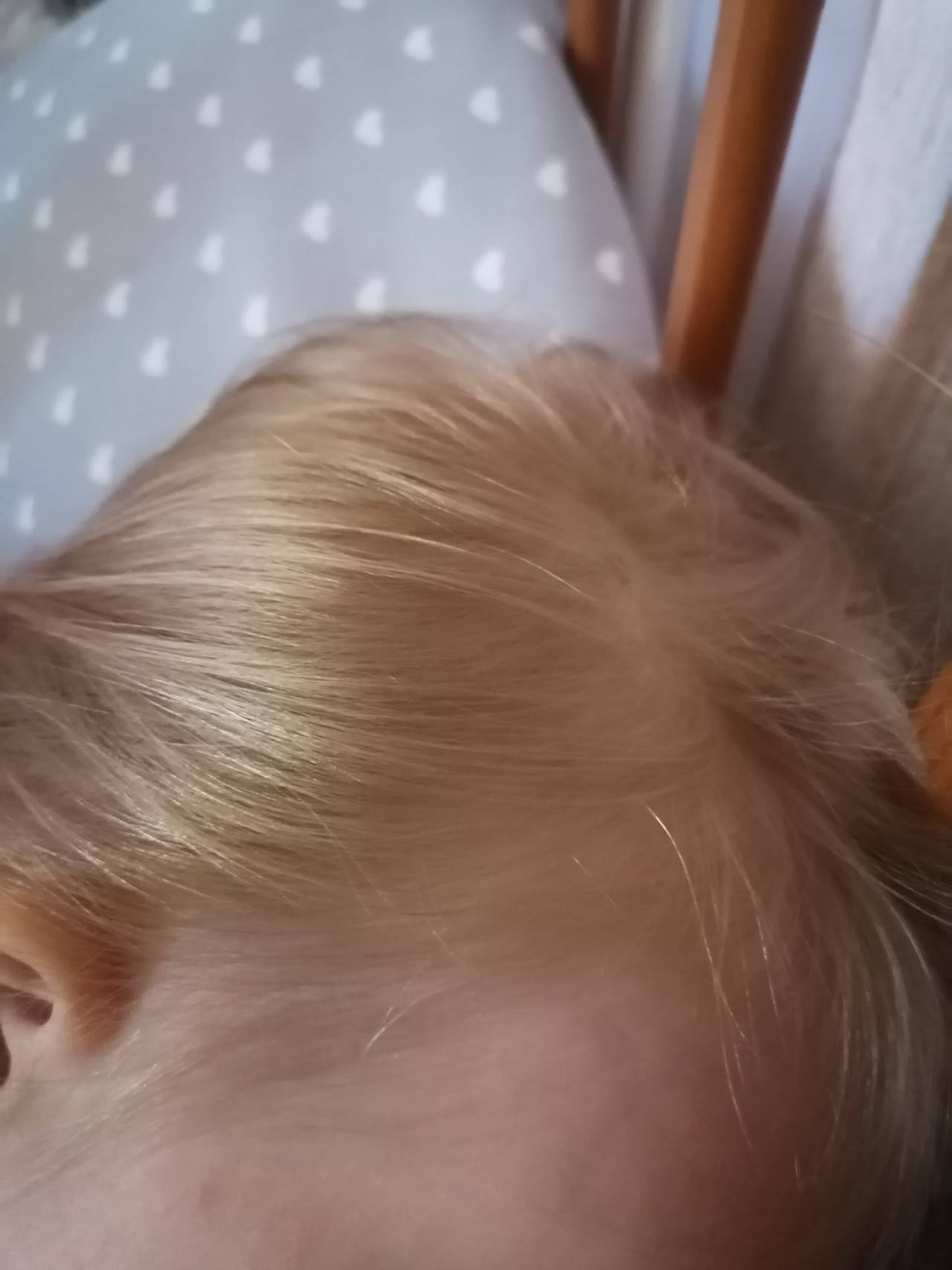 Причины ломкости волос у детей