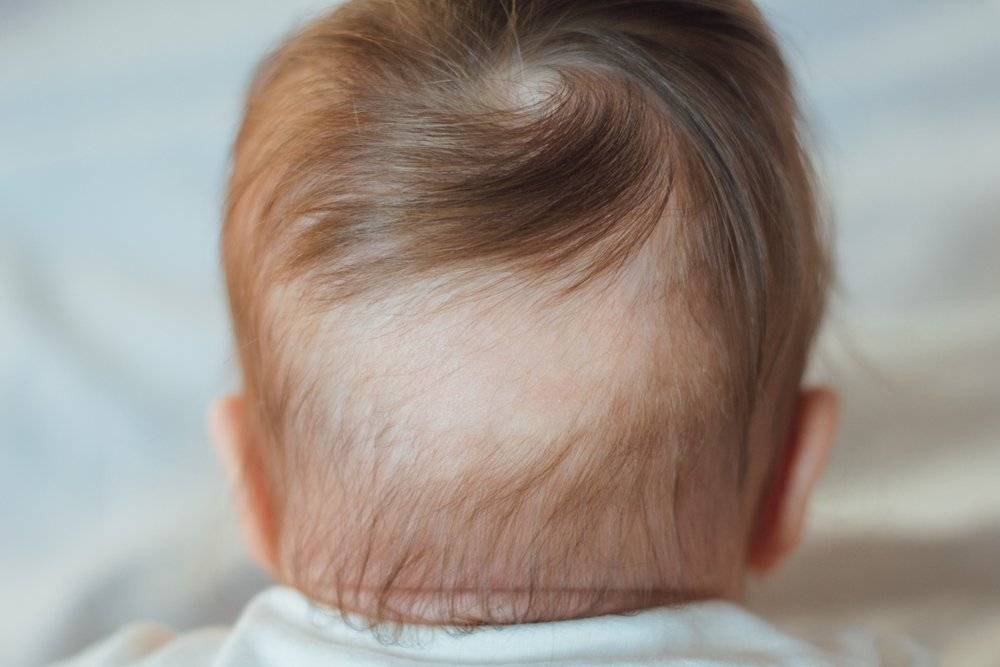 Когда и чем убрать волосы новорожденного