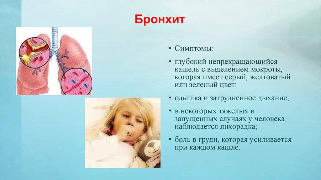 Бронхит у детей: признаки, симптомы и лечение ребенка
