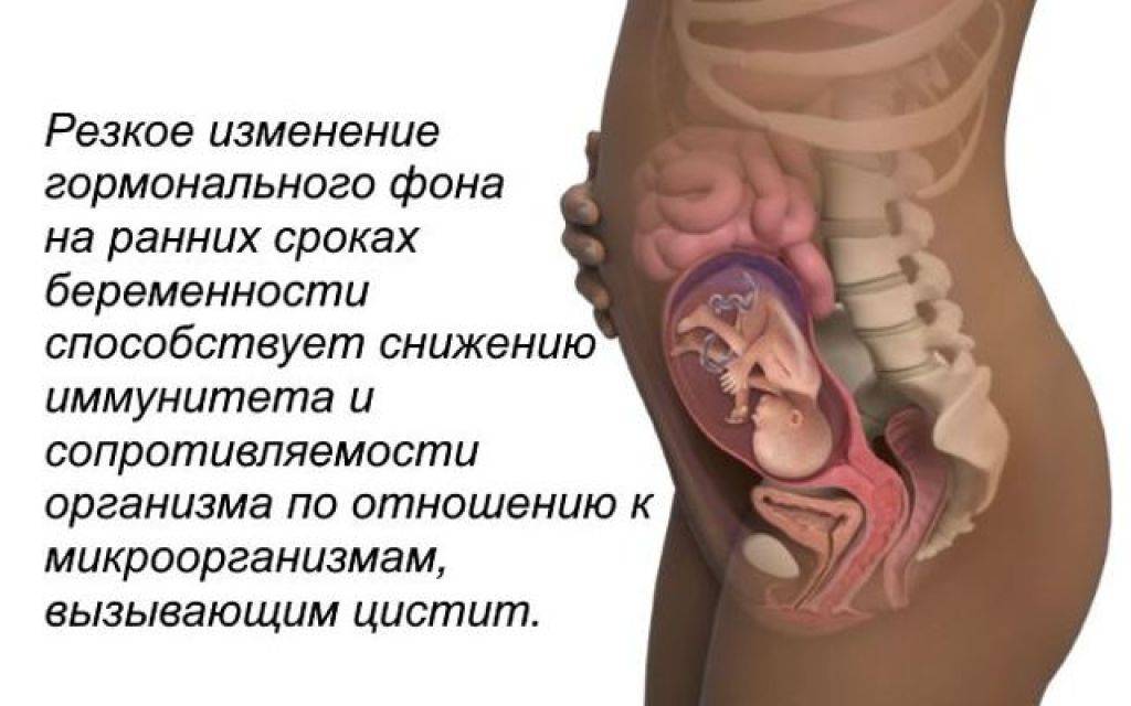 Боли на 1 неделе беременности. Мочевой пузырь при беременности 1 триместр. Цистит на ранних сроках. Цистит на ранних сроках беременности.