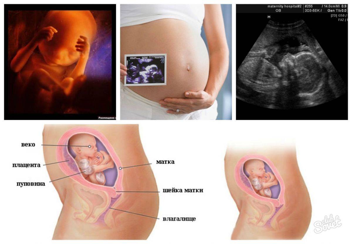 Многоплодие — что ждет будущую маму — патологии