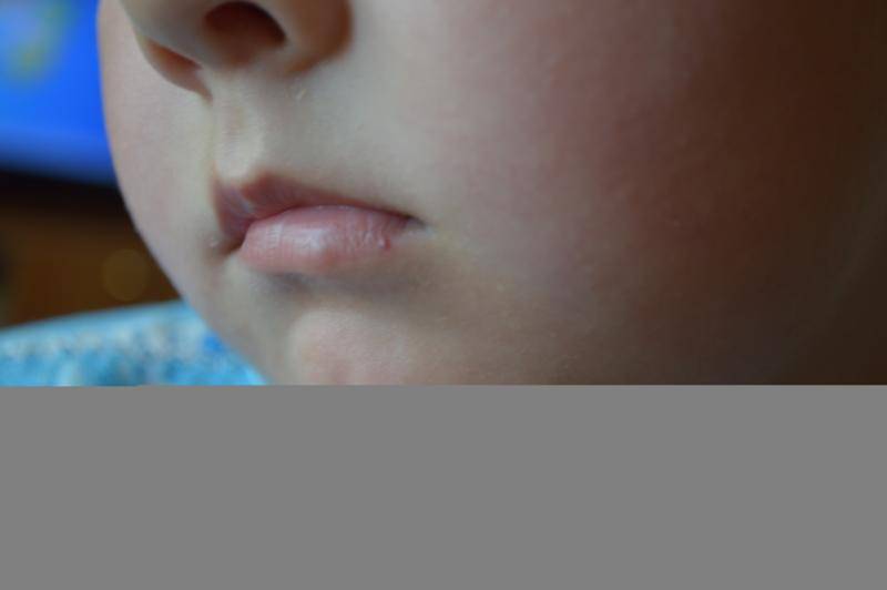 У новорожденного трясется нижняя губа: причины и профилактика | merilin-clinic.ru
