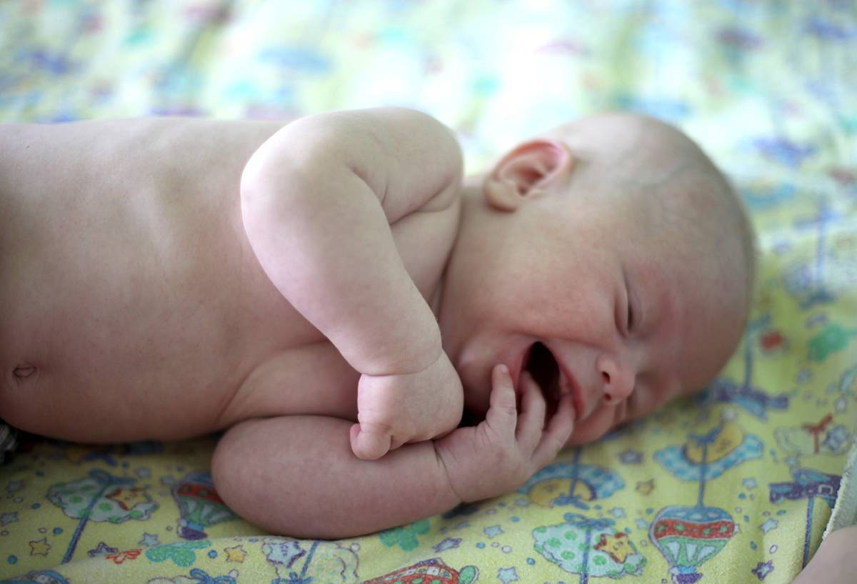 Мраморная кожа у грудничка: причины патологии кожного покрова у новорожденных, мнение комаровского