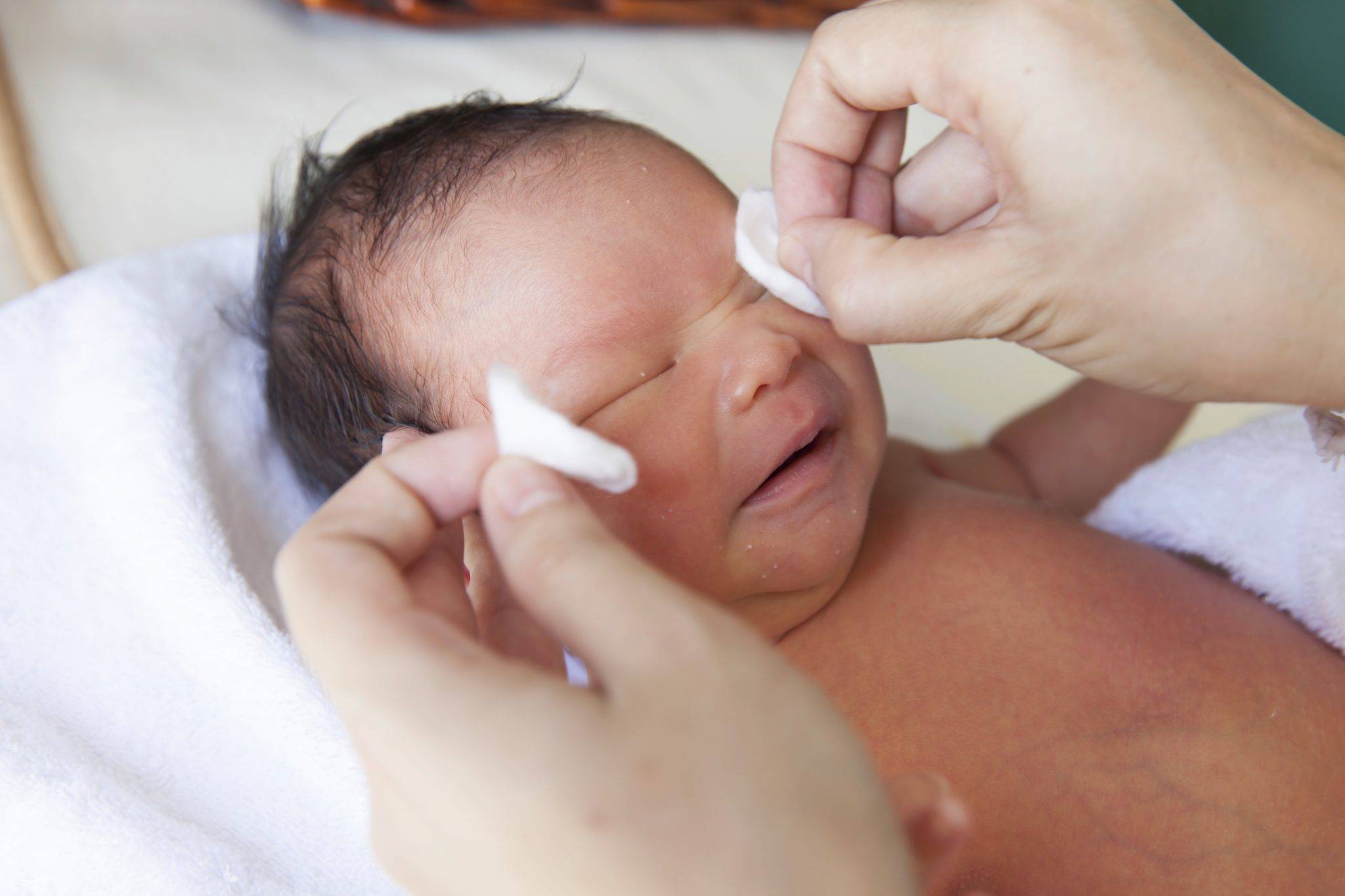 Дакриоцистит у новорожденных | недетские секреты про детей