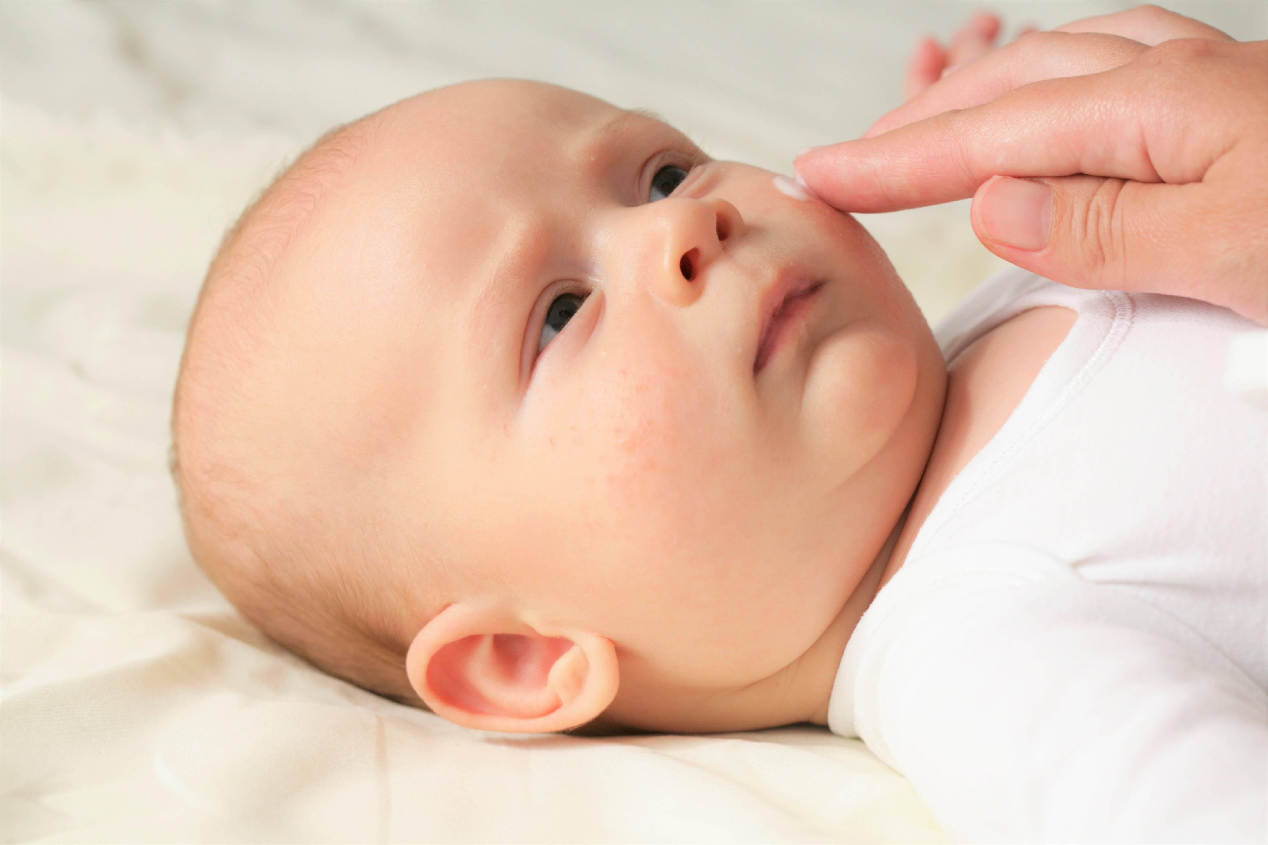 Жировик на лице новорожденного: чем опасен и как избавиться?