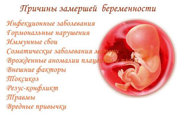 Замершая беременность: причины и лечение * клиника диана в санкт-петербурге