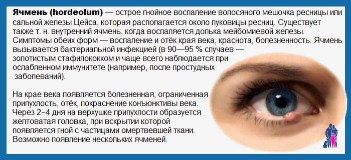 Чем лечить ячмень на глазу. Простудный ячмень на глазу. Как вылечить ячмень на глазу у взрослых. Лечить ячмень на глазу у взрослого. Как лечить ячмень у взрослых на глазу быстро.