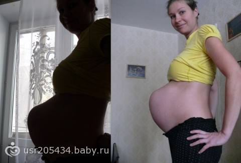 ➤ 34 неделя беременности что нужно знать будущим родителям
