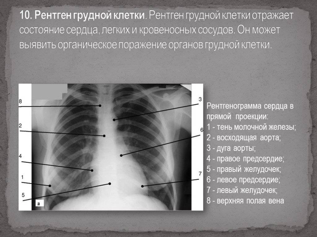 В чем разница между рентгенографией легких и флюорографией