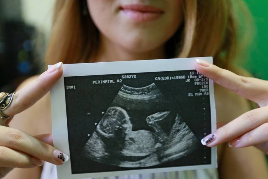 Скрининг при беременности: все об узи беременных