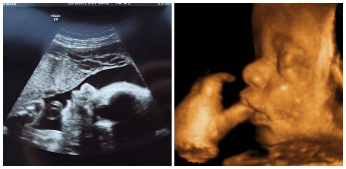 37 недель беременности: тянет низ живота, что происходит с малышом