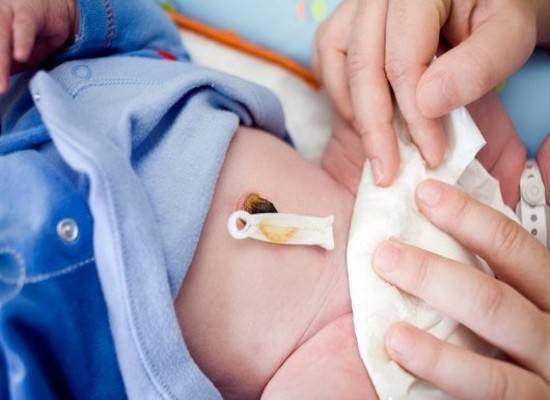 Кровит пупок у новорожденного: что делать, почему, сколько может кровить