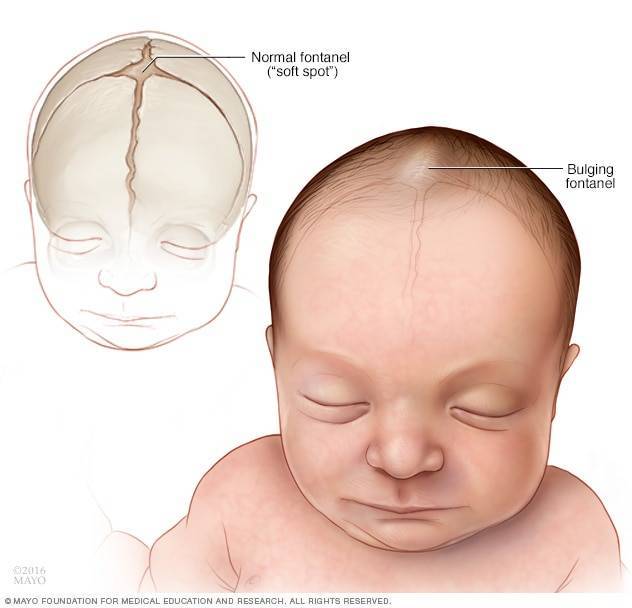 Пульсация родничка у младенца: норма или опасность?