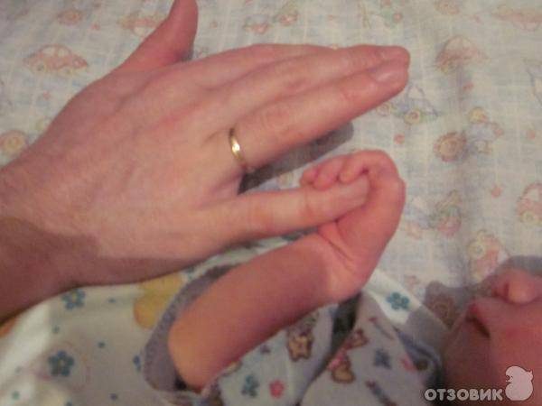 Немеют руки во время беременности: причины, симптомы, лечение