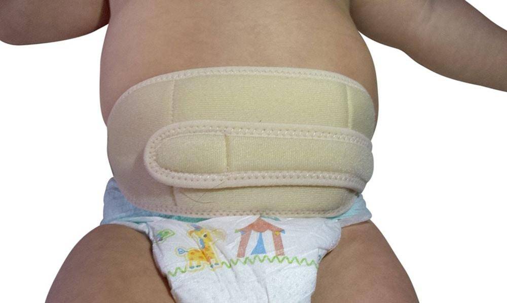 Виды и применение бандажа и пояса для пупочной грыжи для новорожденных