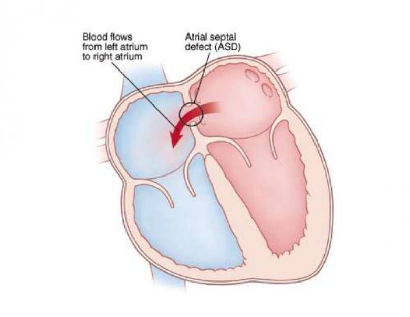 Диагностика и лечение врожденных пороков сердца в клиническом госпитале на яузе