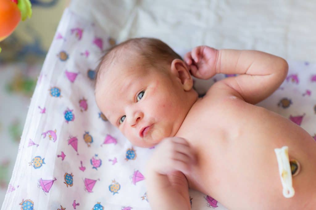 Почему мокнет и сочится пупок у новорожденного ребенка или грудничка: что с этим делать