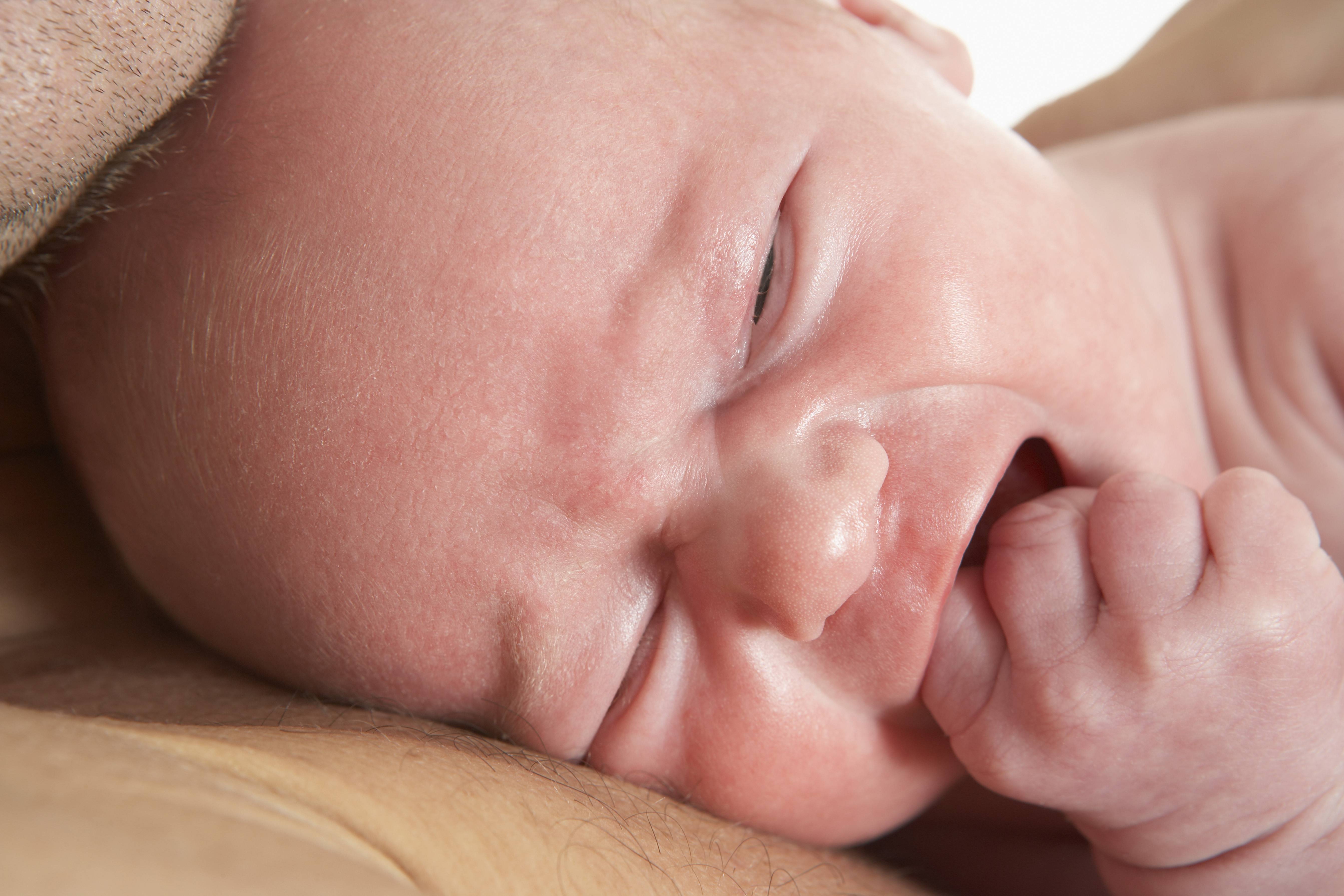 Ранняя реабилитация новорожденных, перенесших перинатальную гипоксию | nasdr