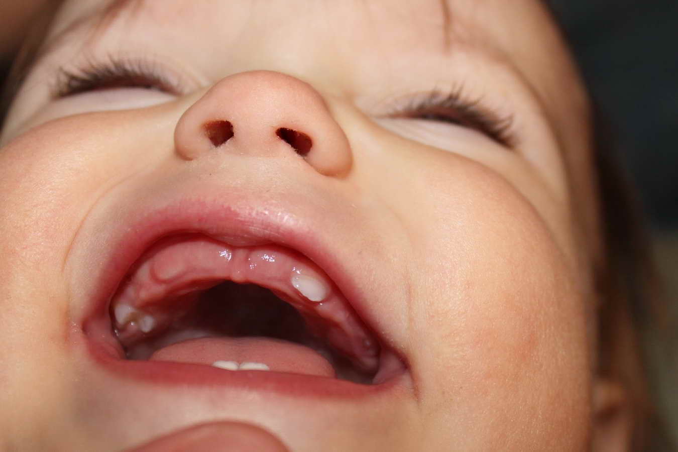 Прорезывание зубов у детей: порядок