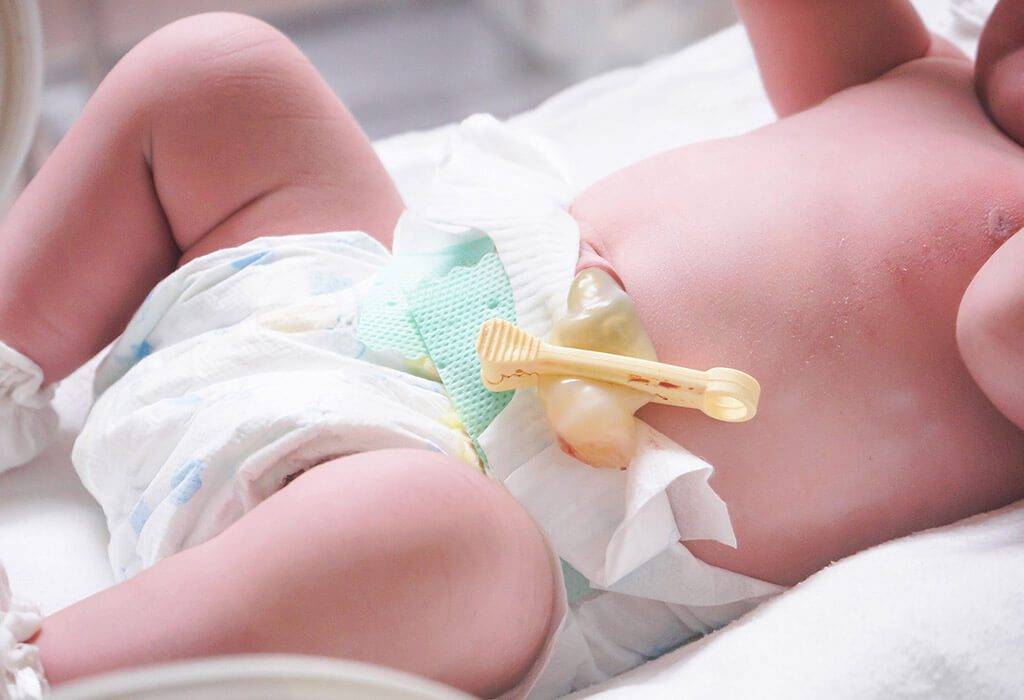 Как правильно обрабатывать пупок у новорожденного?
