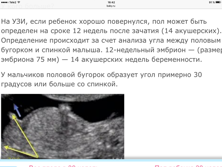 Определение пола ребенка по узи по фото