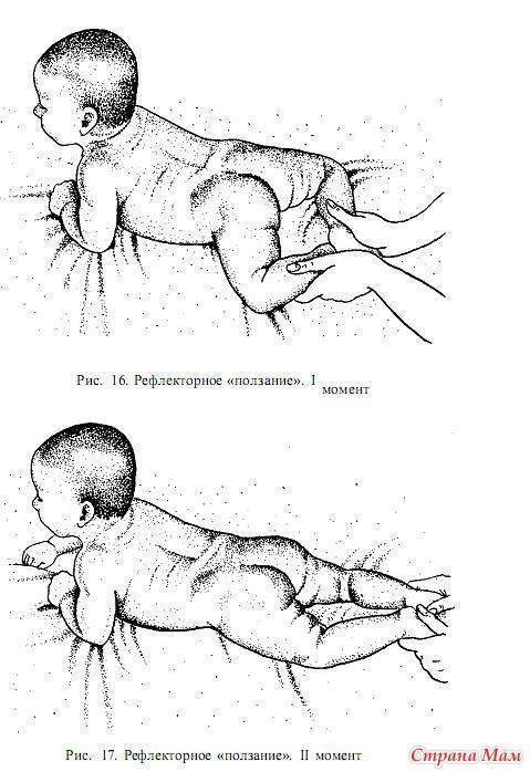 Гипертонус у младенцев
