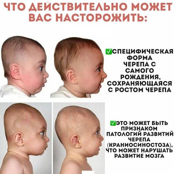 Во сколько зарастает родничок у младенцев - детская городская поликлиника №1 г. магнитогорска