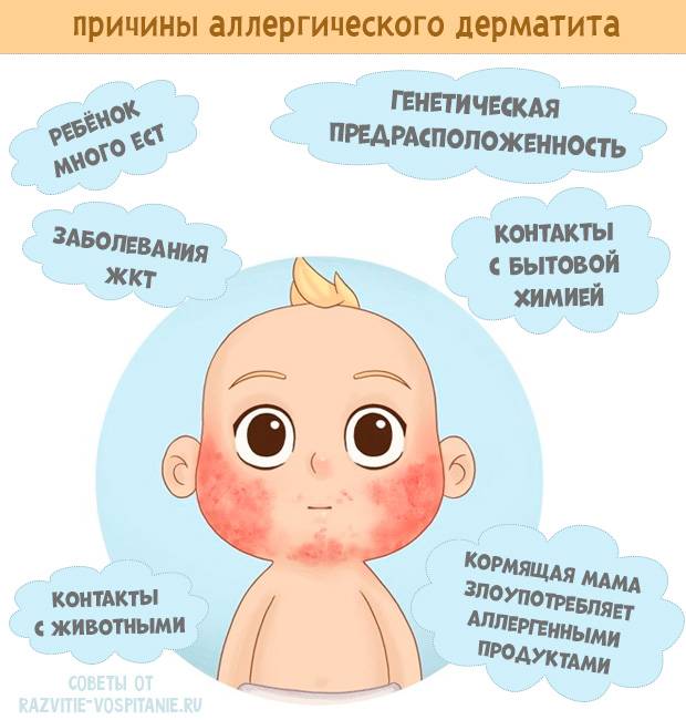 Диатез у новорожденных | энтеросгель